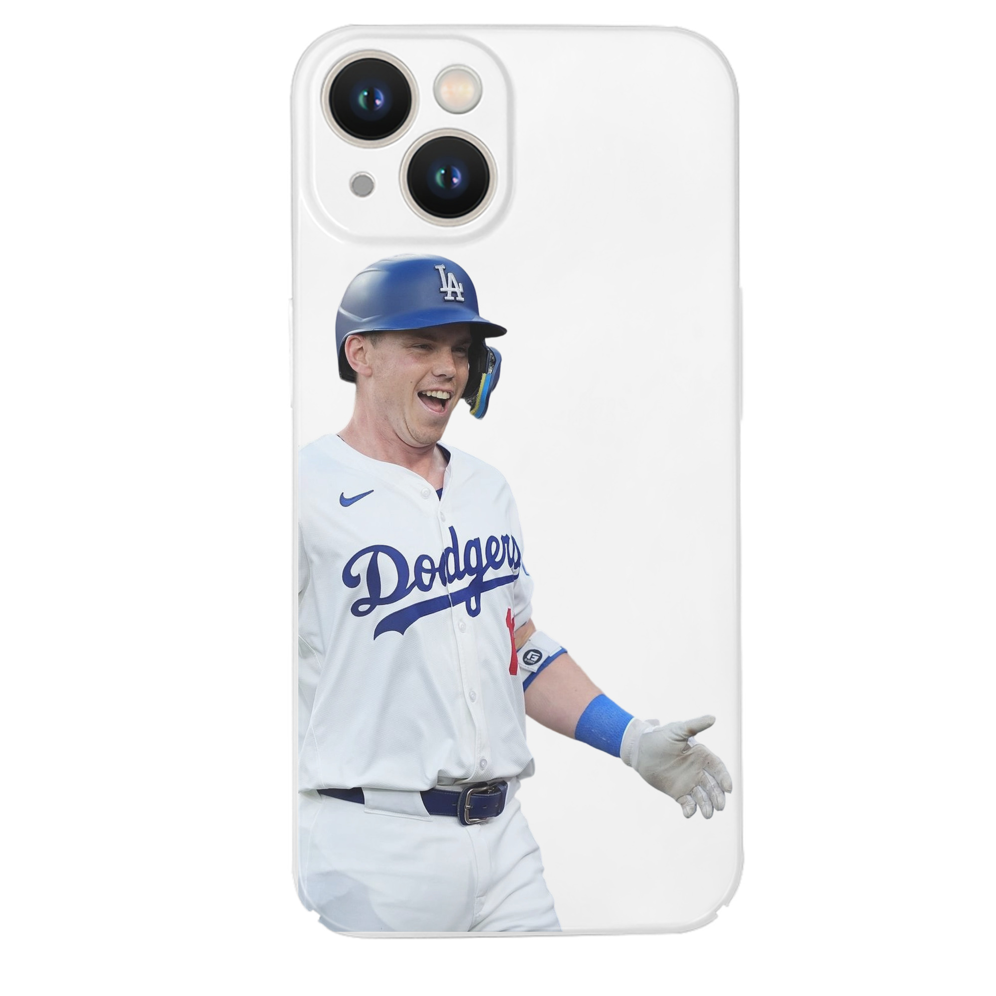  IPhone 14 Series Full-Cover Hard Case – Shockproof With Raised Camera Protection – Precise Cutouts, Wireless Charging Compatible – Durable, Anti-Yellowing, Easy To Clean